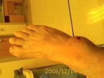 ankle IMAGE 111-1